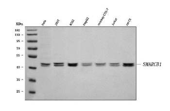 SNF5/SMARCB1 Antibody
