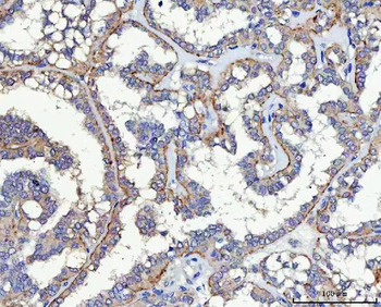 Anti-SLC17A5 Antibody