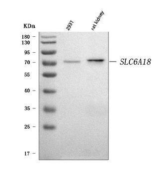 Anti-SLC6A18 Antibody