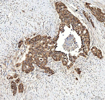 Anti-SINHCAF Antibody