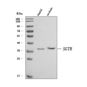 SGT2/SGTB Antibody