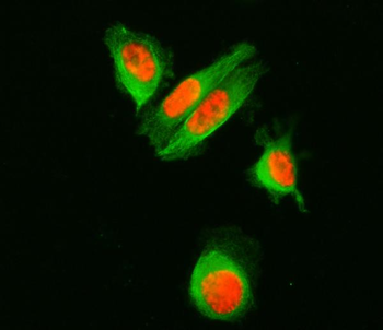 Anti-SF3A1 Antibody