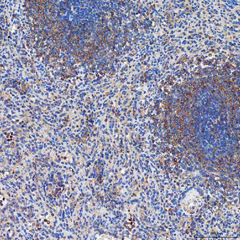 Anti-SETD3 Antibody