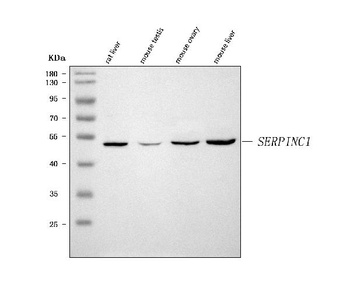 thrombin III/SERPINC1 Antibody