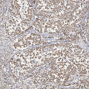 Anti-ACAD9 Antibody