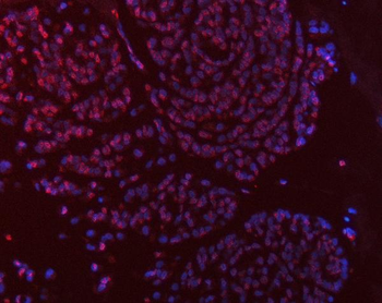 Anti-Thymidylate Synthase/TYMS Antibody