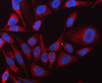Anti-TUFM Antibody