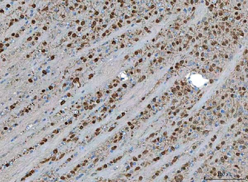 Anti-TSR2 Antibody