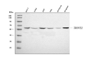 TROVE2/SS-A/RO60 Antibody