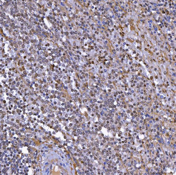 Anti-TOP3B Antibody