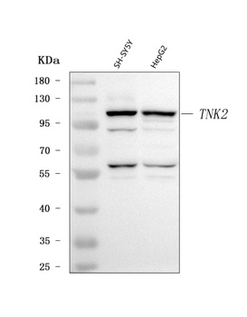 ACK1/TNK2 Antibody