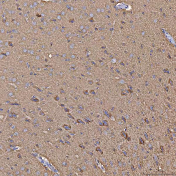 Anti-Selenophosphate synthetase 1/SEPHS1 Antibody