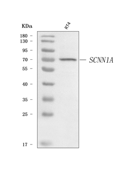 Anti-epithelial Sodium Channel alpha/SCNN1A Antibody