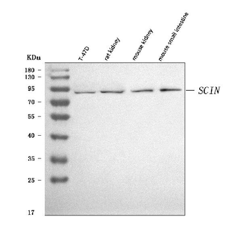 Anti-SCIN Antibody
