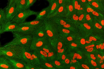 Anti-SART3 Antibody