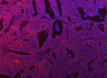 Anti-SARS2 Antibody