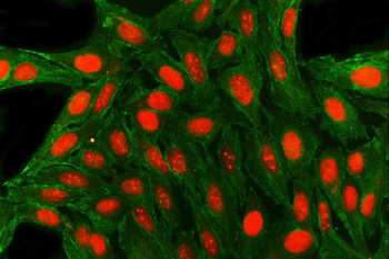 Anti-SAE1 Antibody