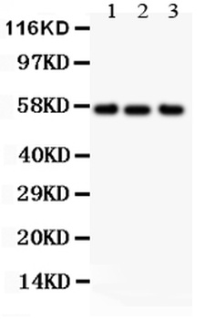 Alkaline Phosphatase/ALPL Antibody