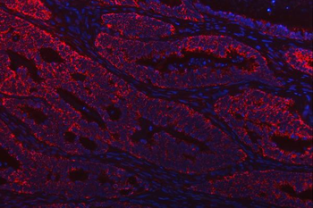 Anti-TST Antibody