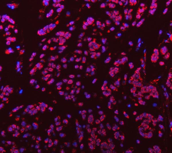 Anti-Sm-D3/SNRPD3 Antibody