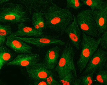 Anti-U1A/SNRPA Antibody
