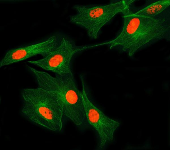 Anti-SNRNP27 Antibody