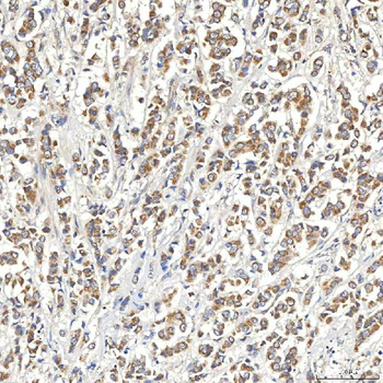 Anti-SNPH Antibody