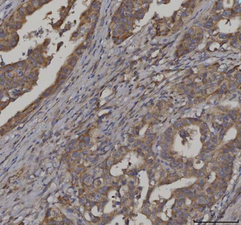 Anti-FATP3/SLC27A3 Antibody