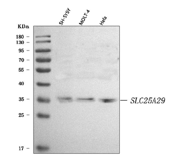 Anti-SLC25A29 Antibody