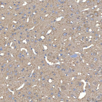 Anti-SLC25A23 Antibody