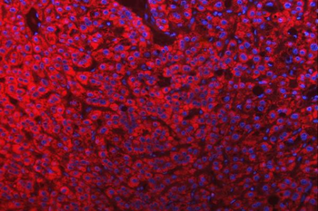 Anti-Mitochondrial dicarboxylate carrier/SLC25A10 Antibody