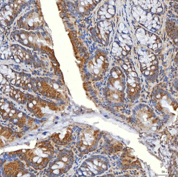 Anti-SLC20A1 Antibody