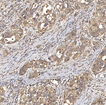 Anti-SIAE Antibody