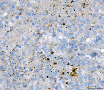 Anti-KLHL12 Antibody (monoclonal, 2G11D1)