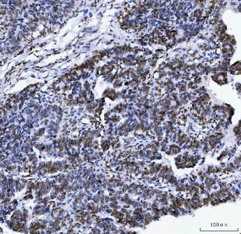Anti-Lamin A+C/LMNA Antibody (monoclonal, 5F3C12)