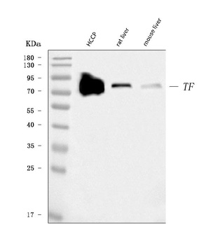 Transferrin/TF Antibody (monoclonal, 7I11B10)