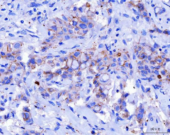 Anti-Desmoglein 2/DSG2 Antibody (monoclonal, 2B4D1)