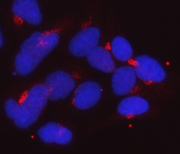 Anti-Golgin 97/GOLGA1 Antibody (monoclonal, 8E4H1)