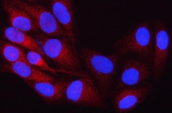 OSBPL8 Antibody