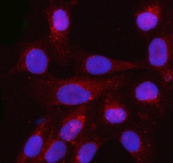 PFN3 Antibody