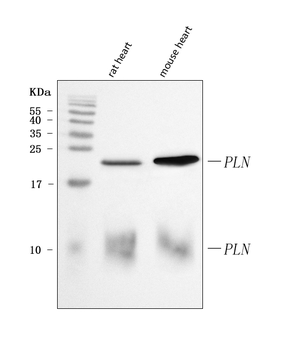 Anti-PLN Antibody