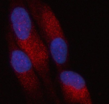 PATL2 Antibody