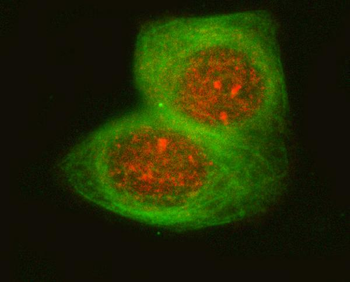 Anti-OSGIN1 Antibody