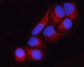 SUCLA2 Antibody