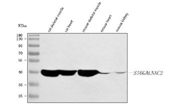 Anti-ST6GALNAC2 Antibody