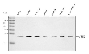 TRAPB/SSR2 Antibody