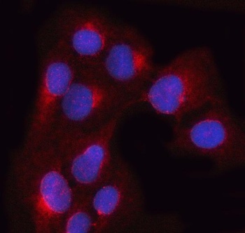 OSTF1 Antibody