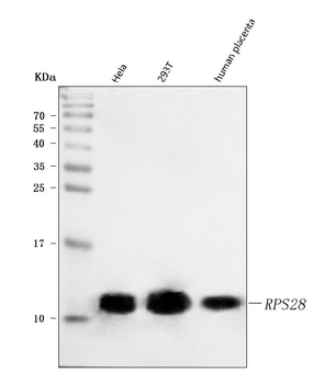 Anti-RPS28 Antibody