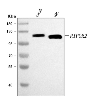FAM65B/RIPOR2 Antibody
