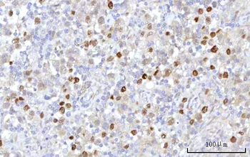 Anti-RRP7A Antibody